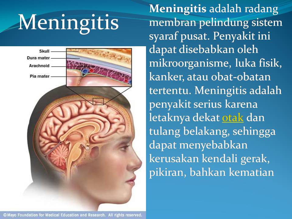 penyebab meningitis